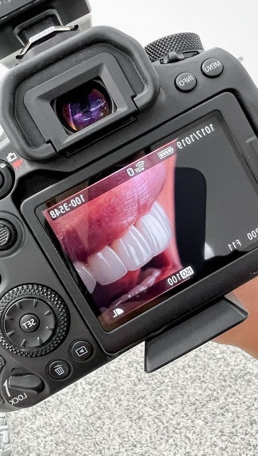 Результат стоматологической работы